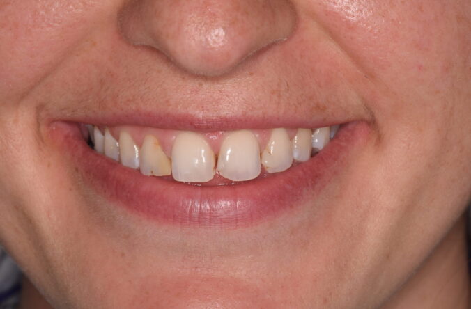 Before - Catherine Court Dentistry