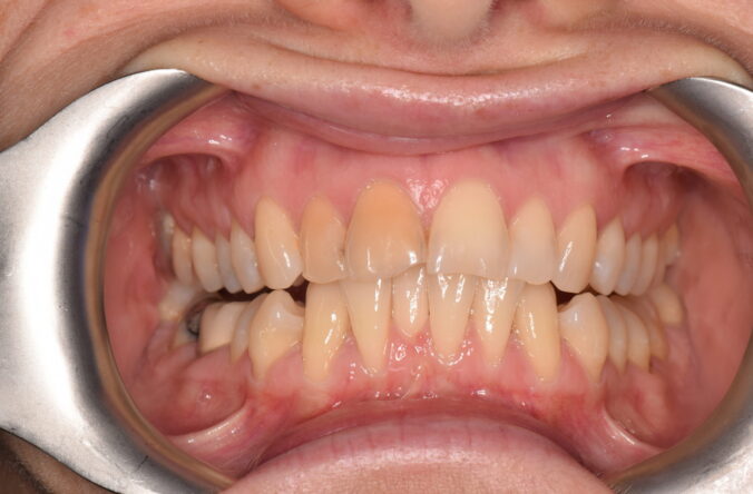 Before - Catherine Court Dentistry