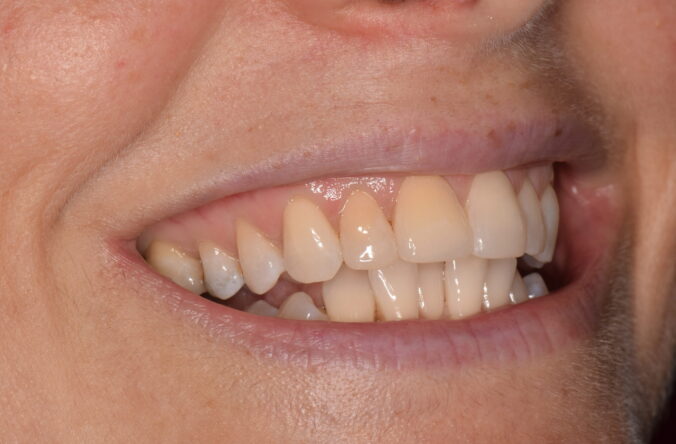After - Catherine Court Dentistry