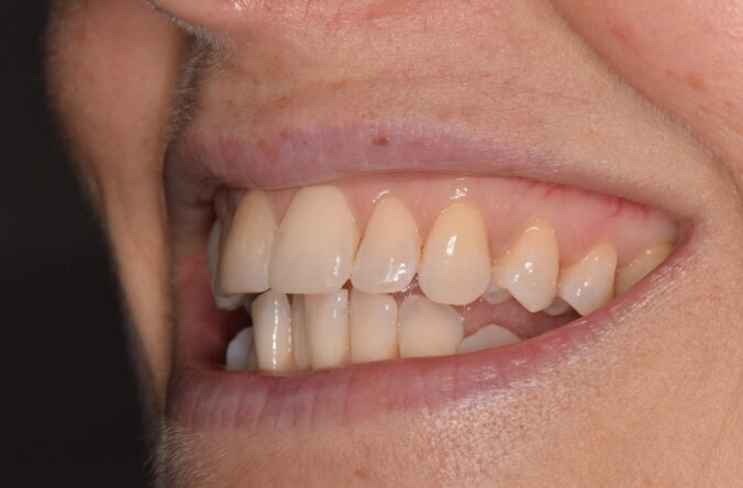 After - Catherine Court Dentistry