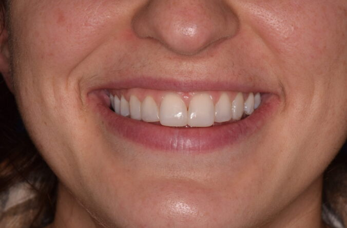Before - Catherine Court Dentistry