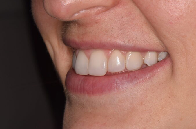 After - Catherine Court Dentistry